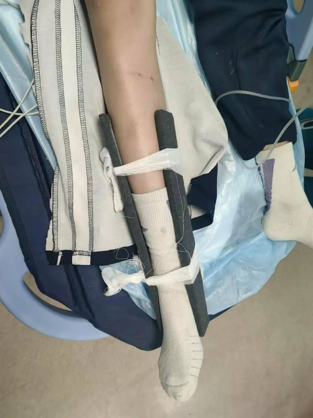 惨痛<strong></p>
<p>链圈</strong>！一人身亡！深圳多名学生骑电动车发生意外
