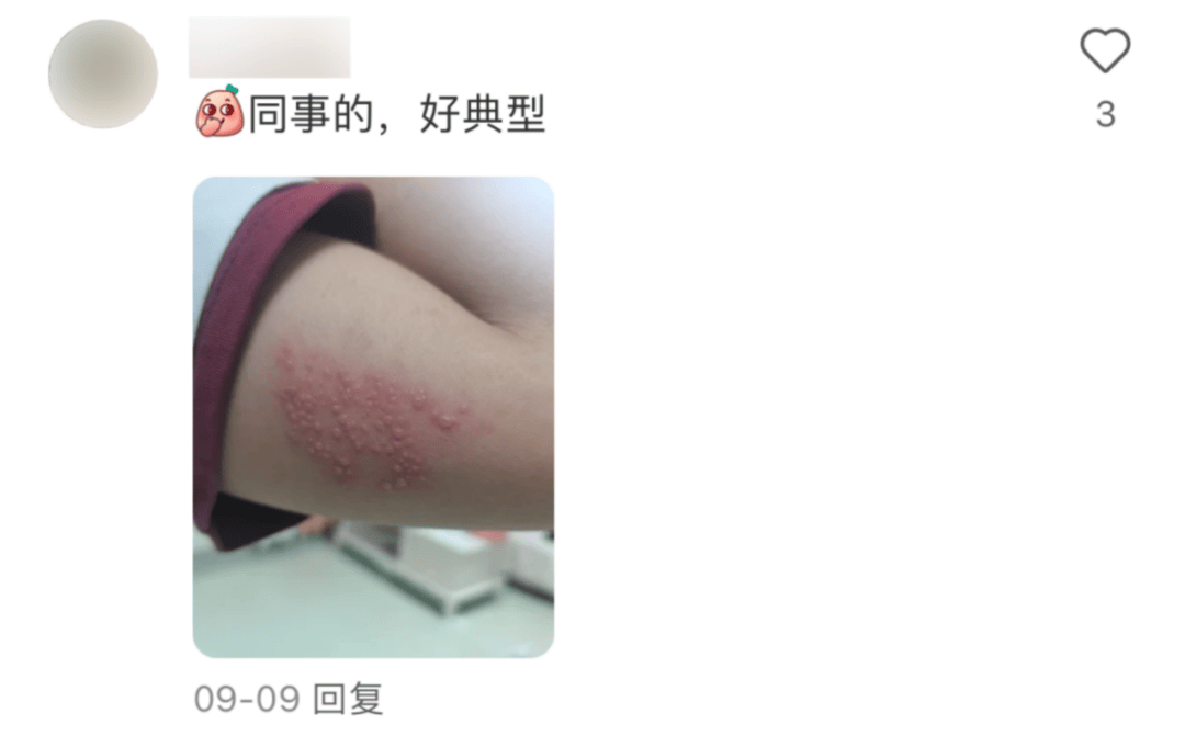 一旦感染终身携带<strong></p>
<p>打制币</strong>！深圳疾控提醒：这4类人要注意