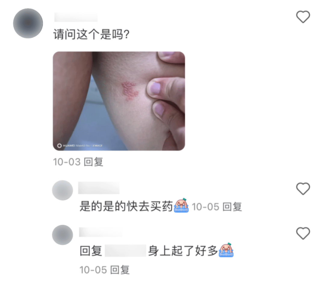 一旦感染终身携带<strong></p>
<p>打制币</strong>！深圳疾控提醒：这4类人要注意