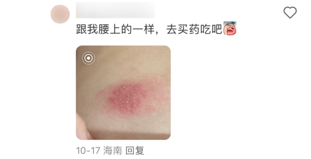 一旦感染终身携带<strong></p>
<p>打制币</strong>！深圳疾控提醒：这4类人要注意