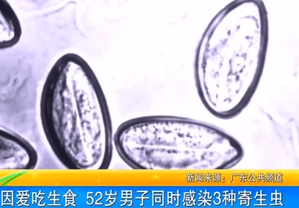 女子体内排出10米长绦虫<strong></p>
<p>职业炒币</strong>！原是两年前旅游时吃了这种食物