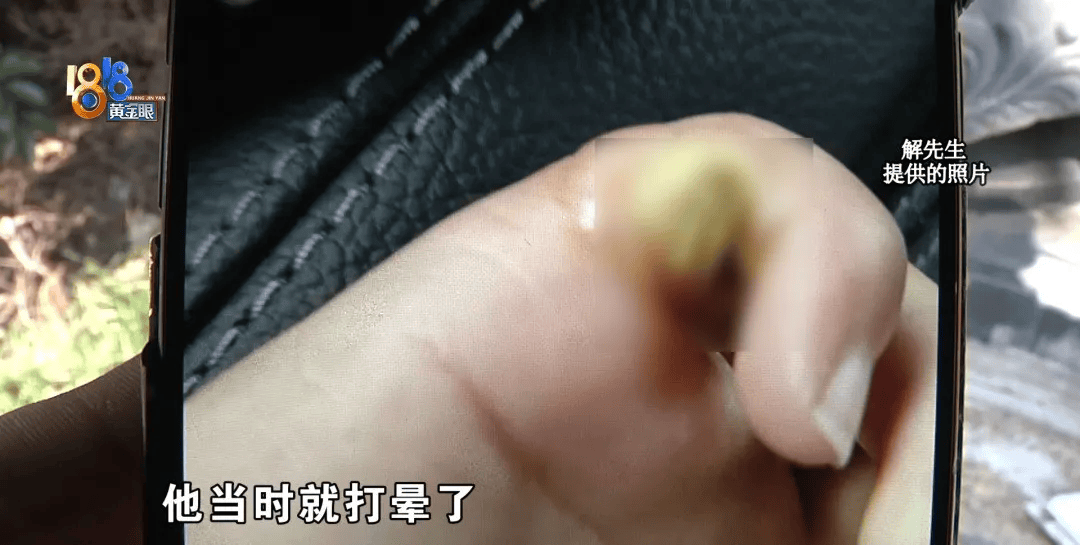 5岁男童瞬间晕厥<strong></p>
<p>瑞郎币哪里购买</strong>，筋都断了！街上常见，看见立即远离