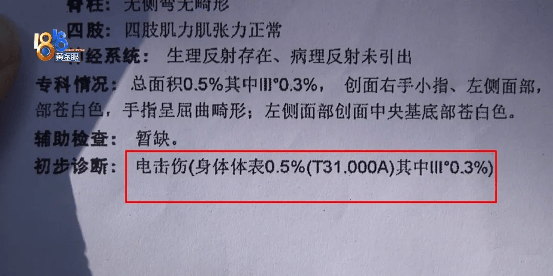 5岁男童瞬间晕厥<strong></p>
<p>瑞郎币哪里购买</strong>，筋都断了！街上常见，看见立即远离