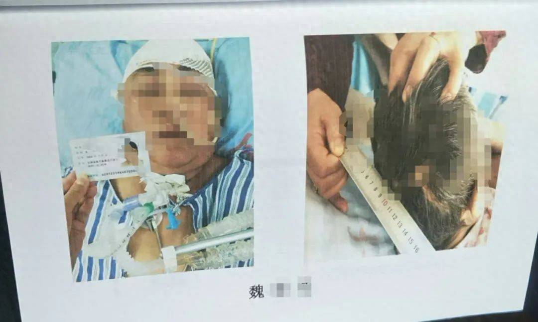 目睹母亲过马路被车撞<strong></p>
<p>币虎交易</strong>，27岁女子受惊吓5天后身亡