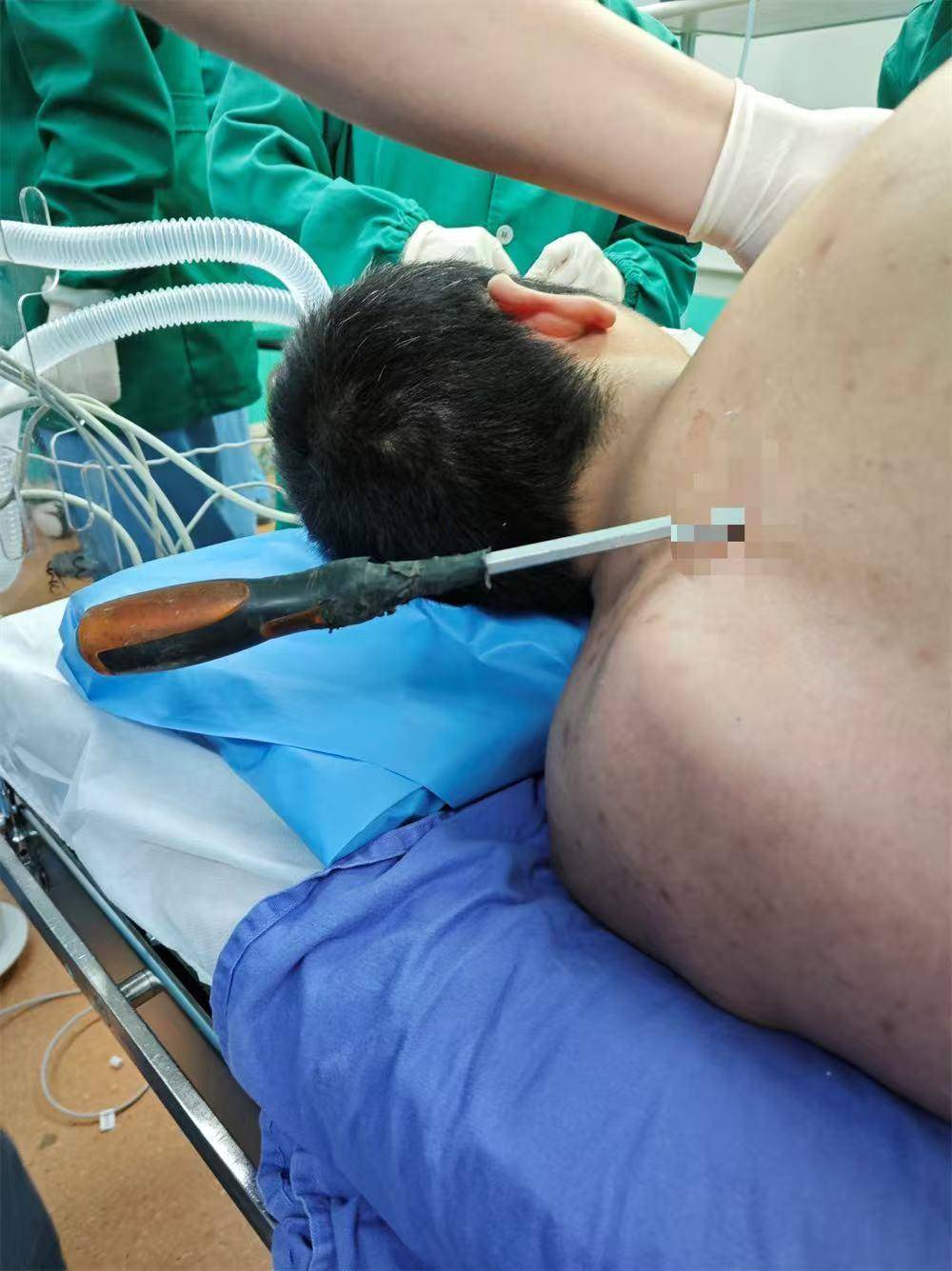 20米高空掉落螺丝刀直插男子胸腔<strong></p>
<p>炒币秘籍</strong>！医生：不要自行拔除