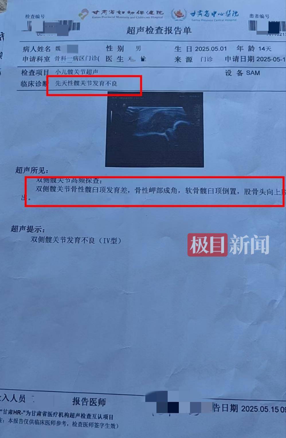 二胎出生查出先天性病症或落下残疾<strong></p>
<p>币圈入门</strong>，残疾父母称医院产检漏检、未尽告知义务，医院及医调委回应