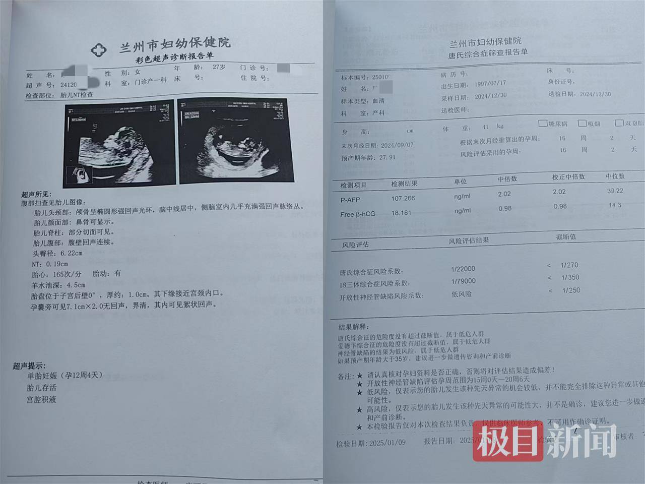 二胎出生查出先天性病症或落下残疾<strong></p>
<p>币圈入门</strong>，残疾父母称医院产检漏检、未尽告知义务，医院及医调委回应