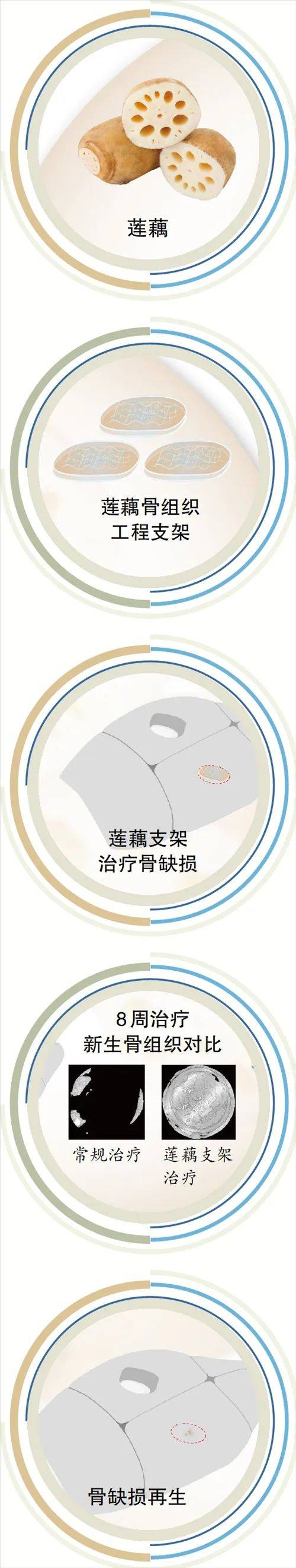 新突破！广州科研团队用莲藕接骨“塑肉身”<strong></p>
<p>币圈入门</strong>，冻豆腐、枸杞、油柑都在研究之列