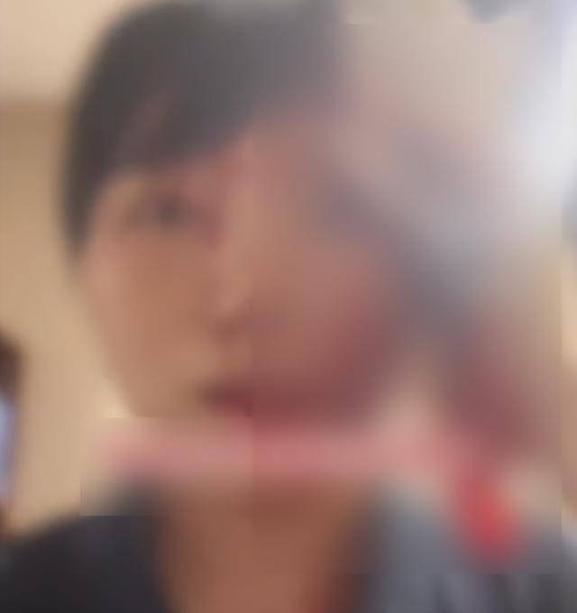 缝了20多针！女子称被不知名男同事砸头毁容<strong></p>
<p>币多多交易</strong>，警方介入