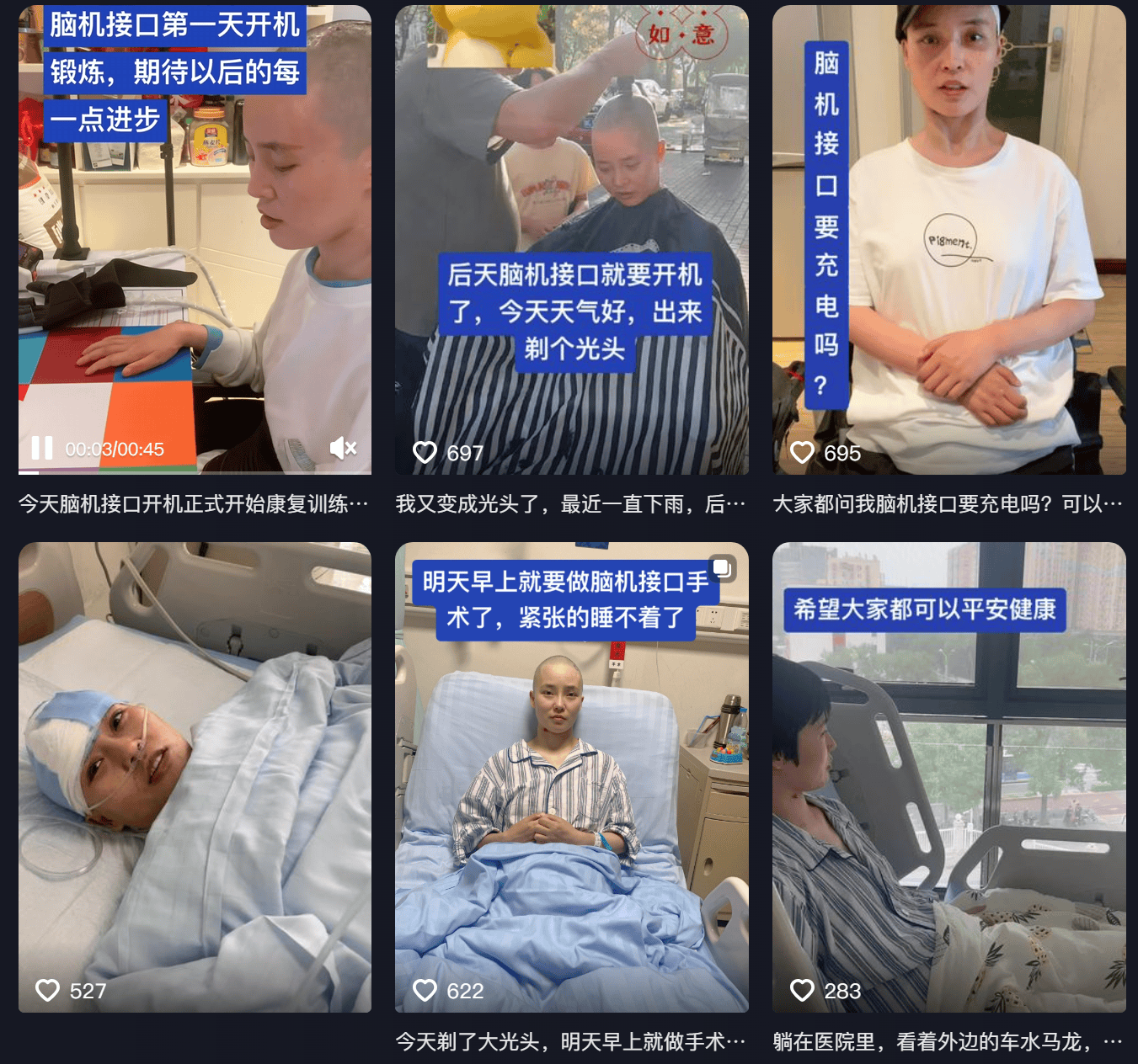 女子因车祸全身瘫痪6年仅嘴眼能动<strong></p>
<p>炒币亏</strong>，接受脑机接口手术后通过意念抓取物品！当事人讲述