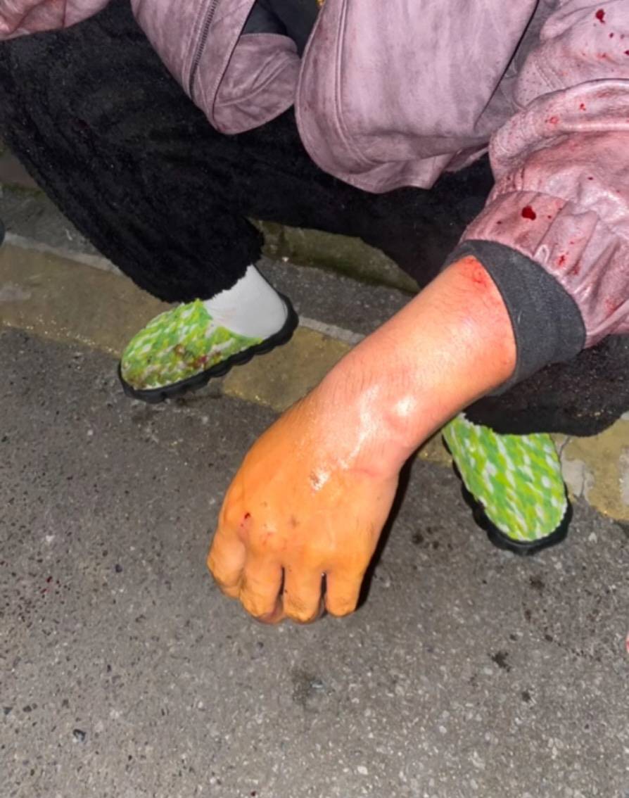 株洲女子夜间遭同小区大狗扑咬<strong></p>
<p>柚子币走势</strong>,男子从二楼冲下死死摁住肇事狗,众居民:一定要表扬他